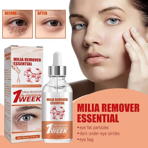 Smooth Milia Remover Serum (Original)